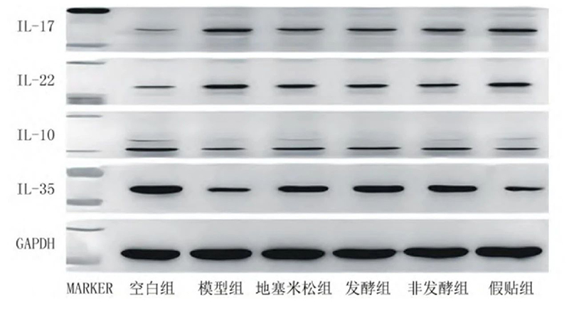 空白组和支气管哮喘各组大鼠肺组织中IL－17、IL－22、IL－10、IL－35蛋白表达电泳图